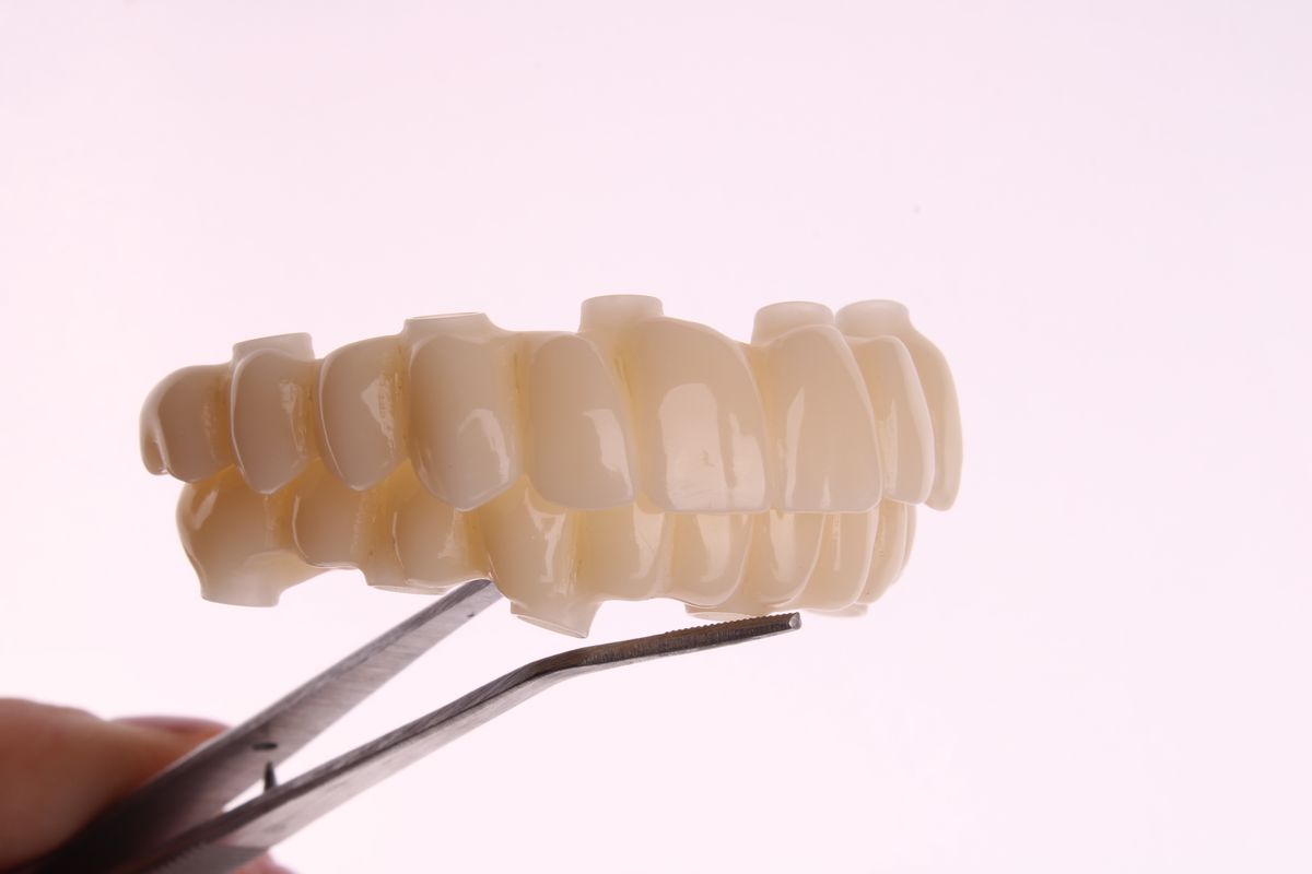 Arcada superior en zirconia