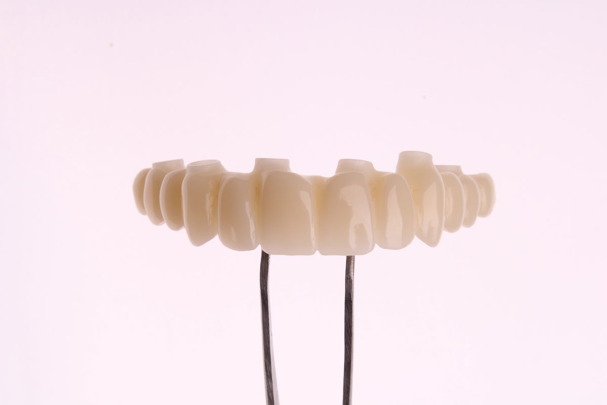 Prótesis completa sobre implantes